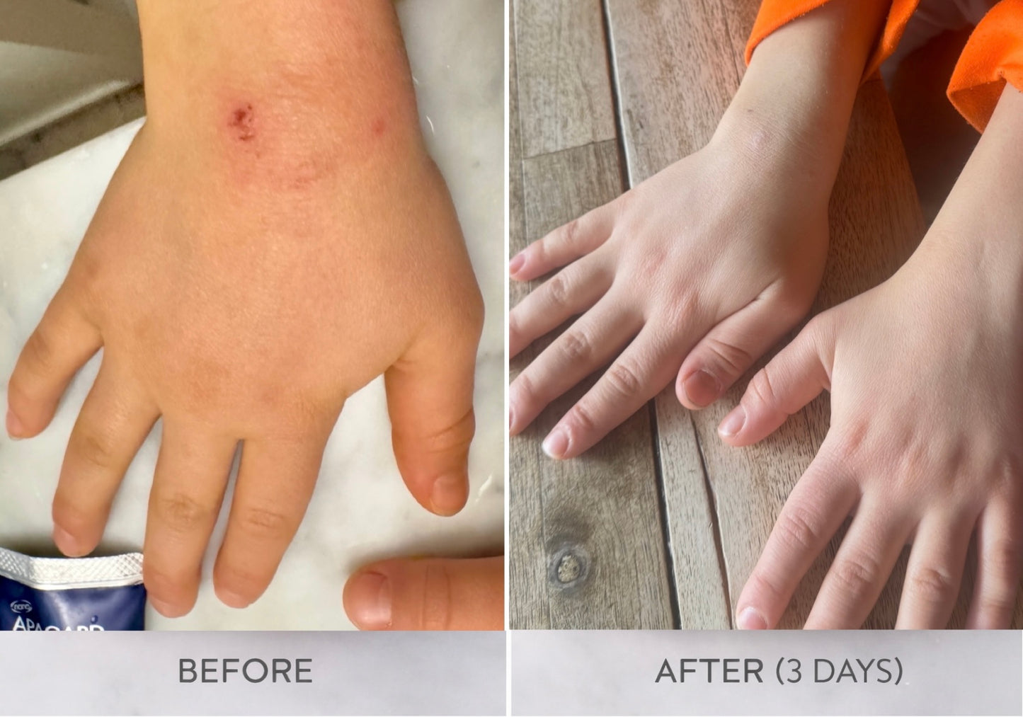 Miracle Fix Barrier Repair Balm