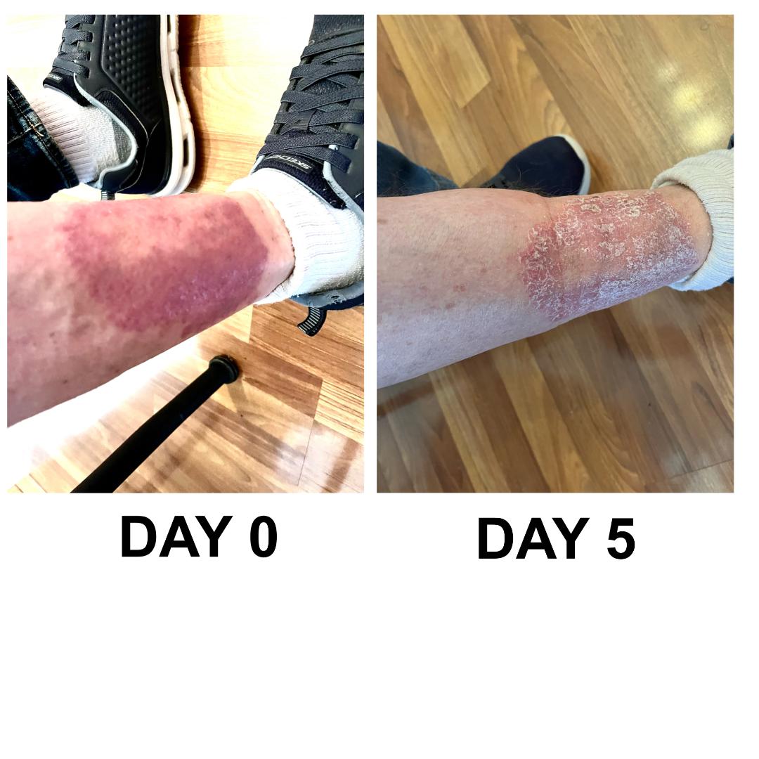 Miracle Fix Barrier Repair Balm