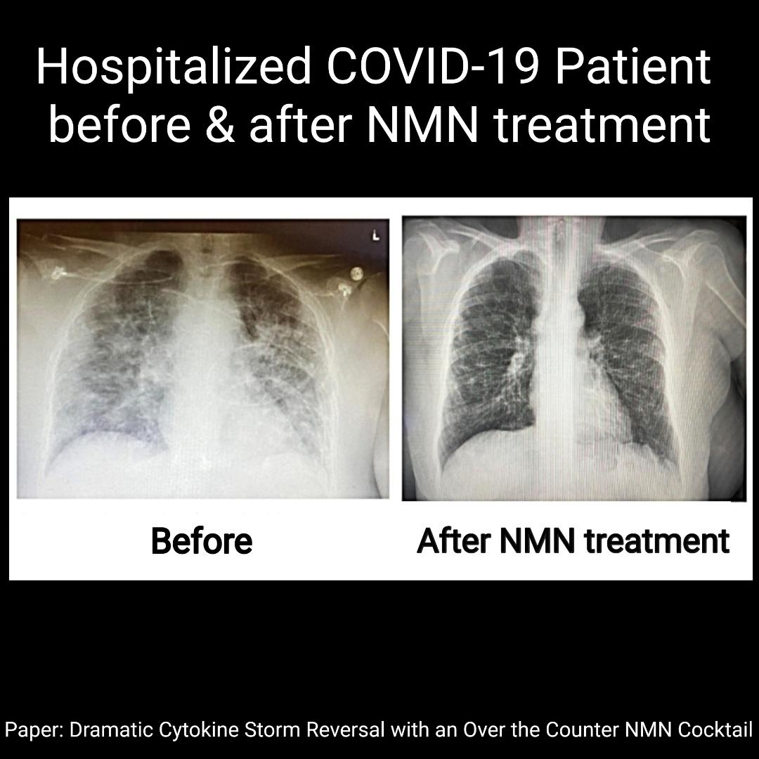 NMN - mitochondria support*